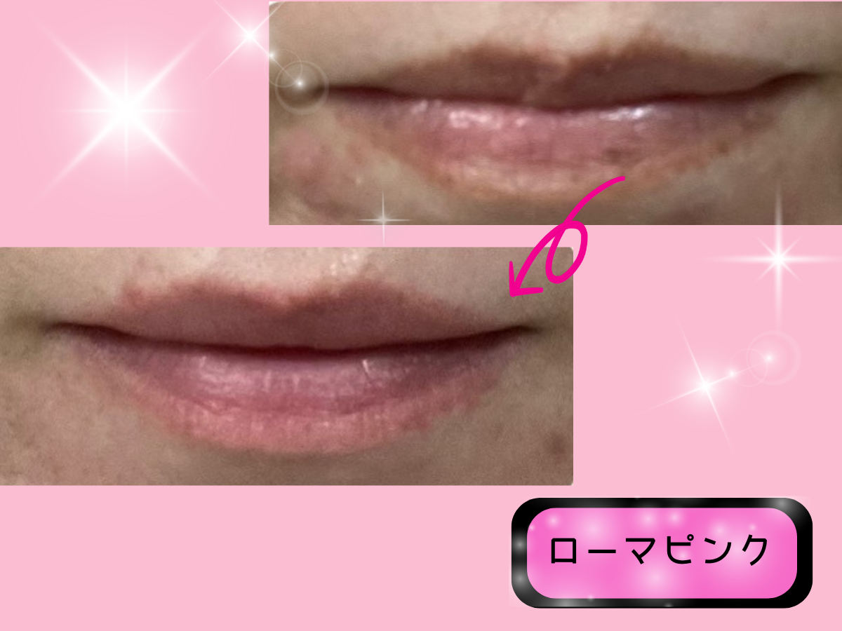 メラニンケア「ローマピンク」を唇にした結果☆ - そばにある